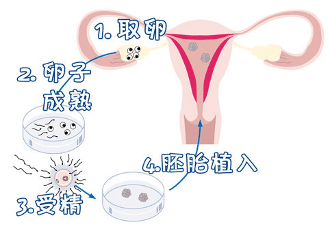 供卵代怀包男孩